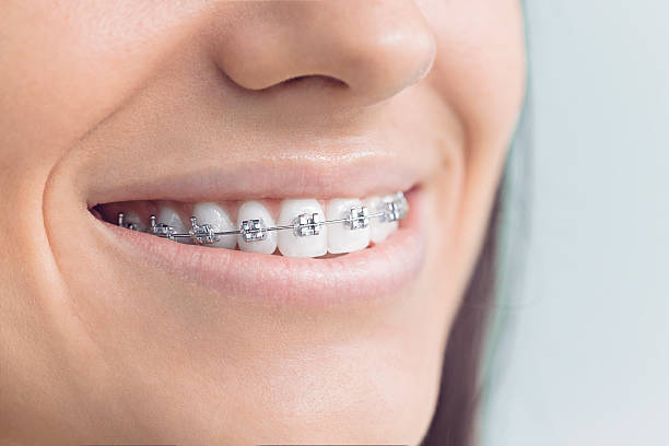 Best Dental Fillings (Composite and Amalgam)  in Monroe, WA